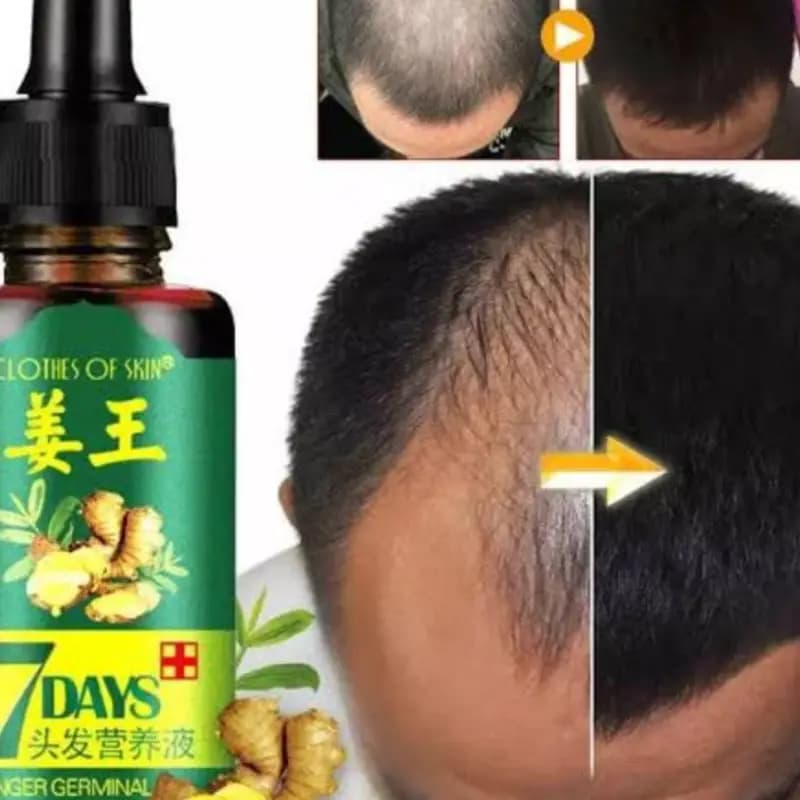 Nourishing Hair Growth Serum - 30ml